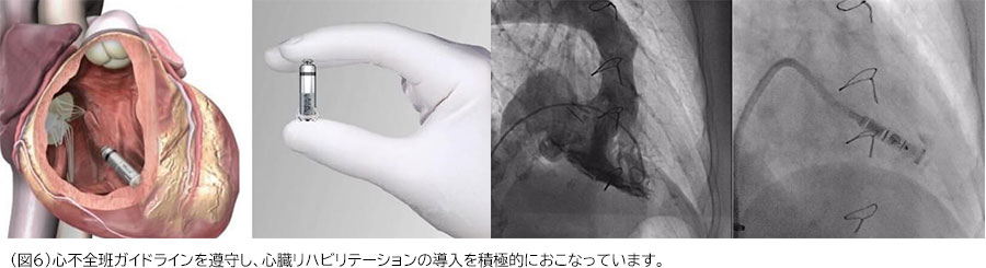 （図6）心不全班ガイドラインを遵守し、心臓リハビリテーションの導入を積極的におこなっています。