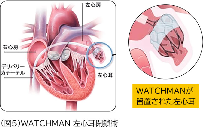 不整脈班 - 研究班紹介 | 藤田医科大学 循環器内科 研修医採用サイト